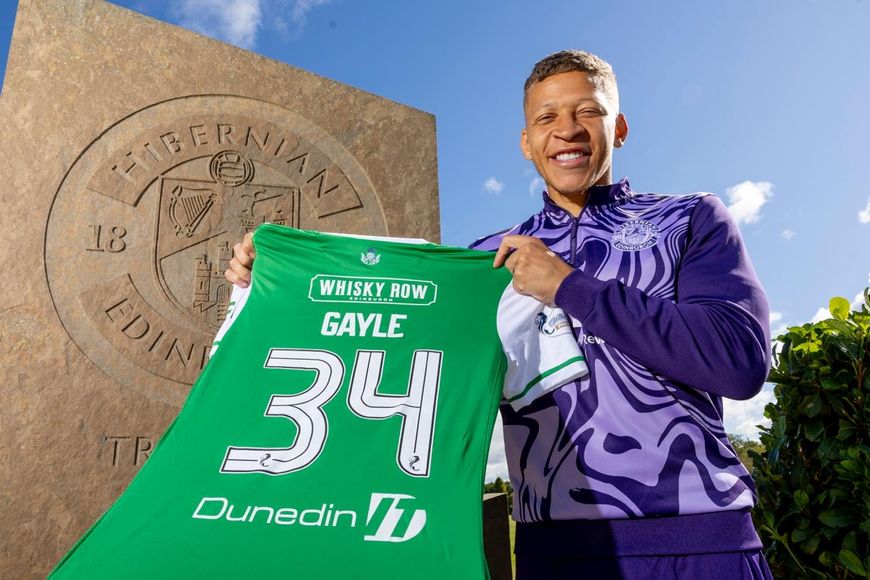 Hibernian FC | Dwight Gayle